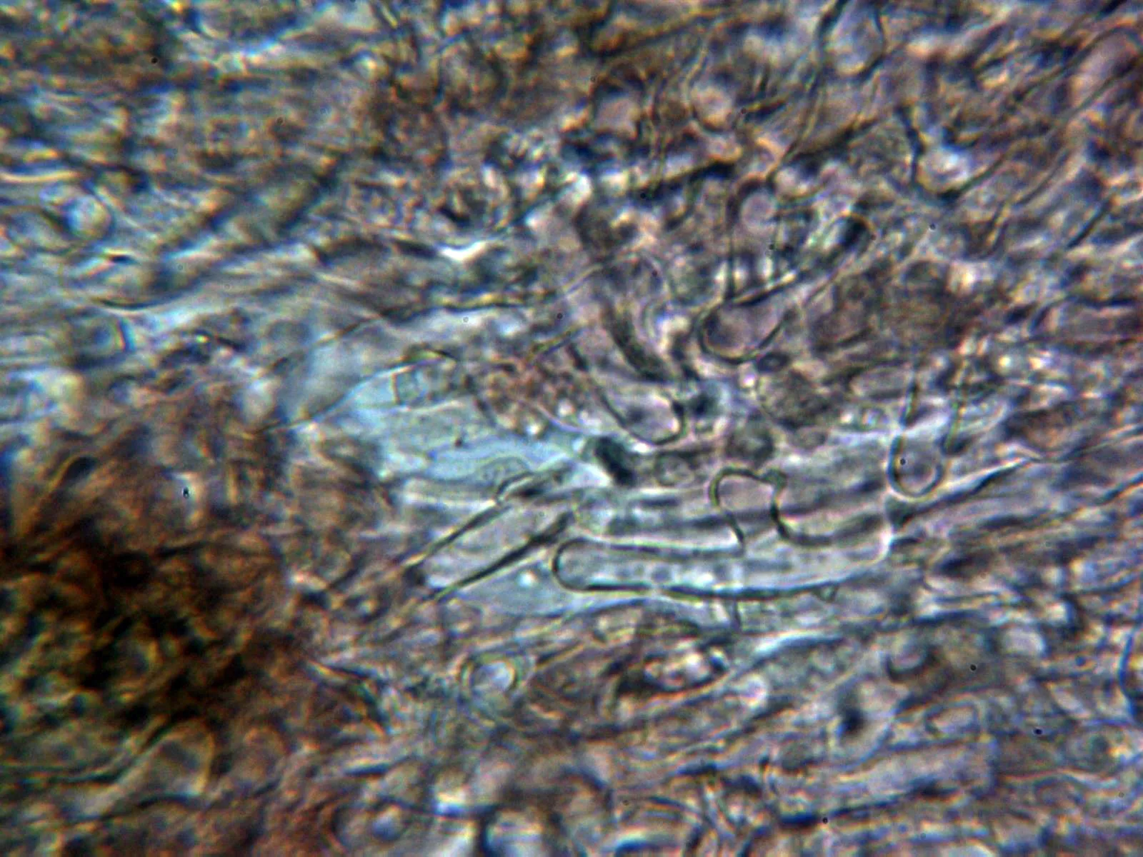 Microscopía de Simocybe haustellaris - 10 - Cutícula 2